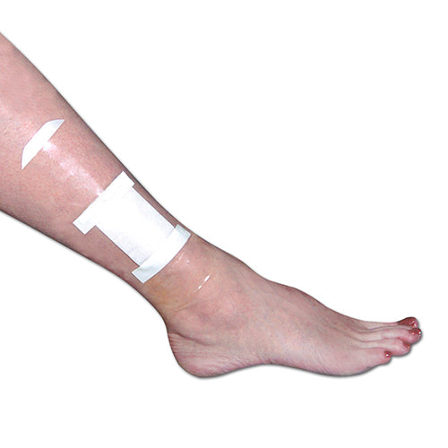SEAL-TIGHT Shield (Pk/5) Dressing & Wound Protector